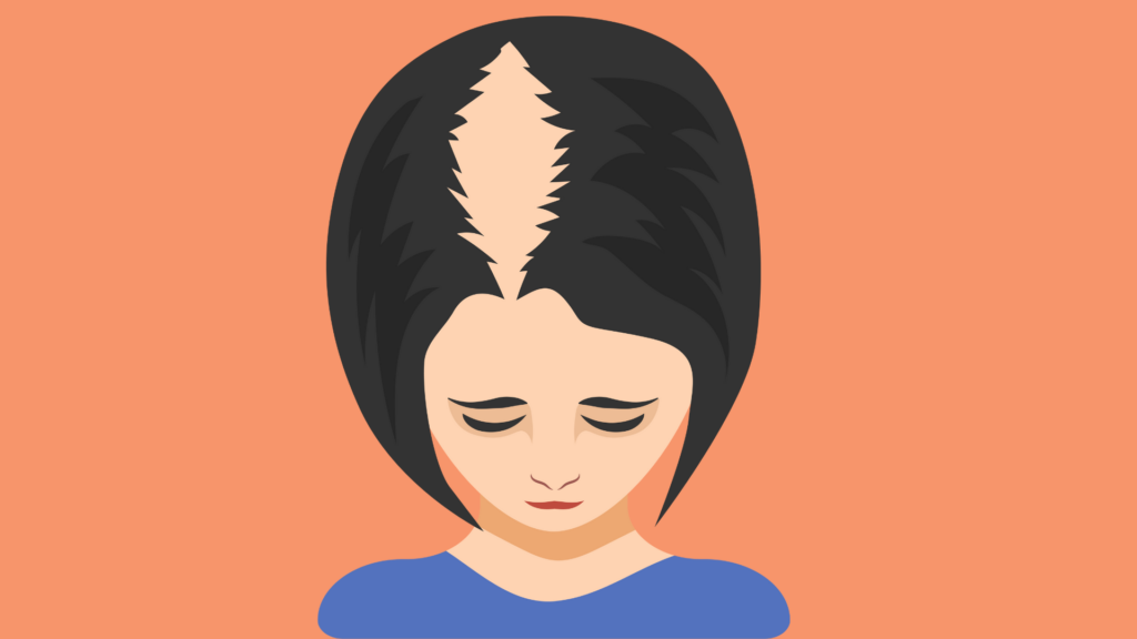 Hair Thinning and Hair Loss: Hers's All you need to know